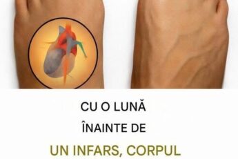 9 Semne de avertizare Corpul tău îți oferă o lună înainte de un atac de cord
