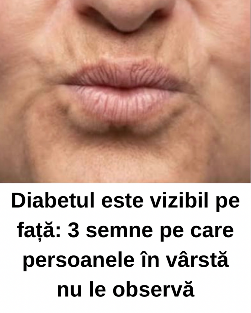 Diabetul este vizibil pe față. Persoanele în vârstă nu le observă.