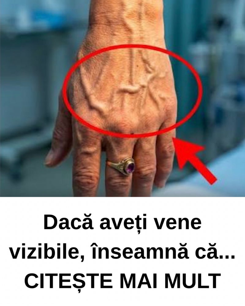 Dacă aveți vene vizibile, atunci înseamnă că....