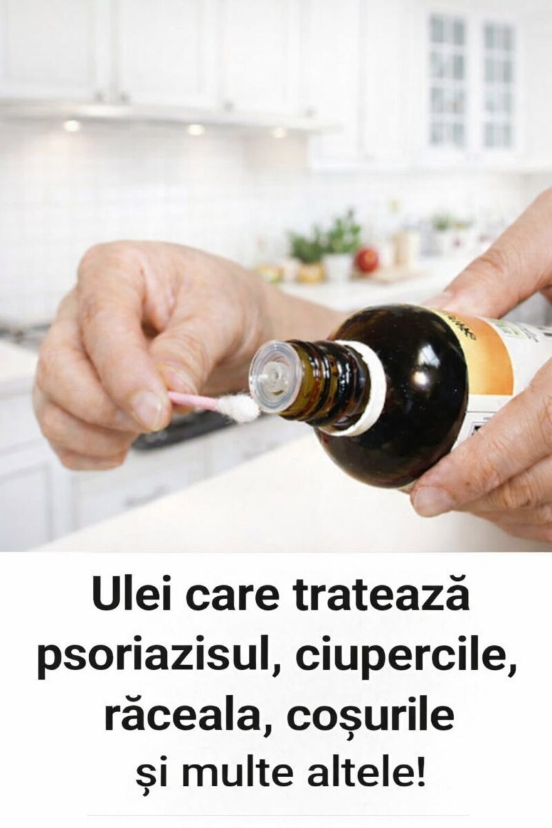 Ulei care tratează psoriazisul, ciuperca, răceala, coșurile și multe altele!