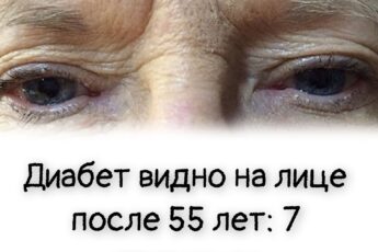Диабет видно на лице после 55 лет: 7 признаков повышенного сахара
