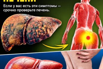 Обратите внимание на 12 малозаметных признаков заболеваний печени. Эти симптомы категорически нельзя оставлять без внимания — они позволят своевременно уберечь организм и спасти жизнь. Подробности читайте в первом комментарии под этим постом…