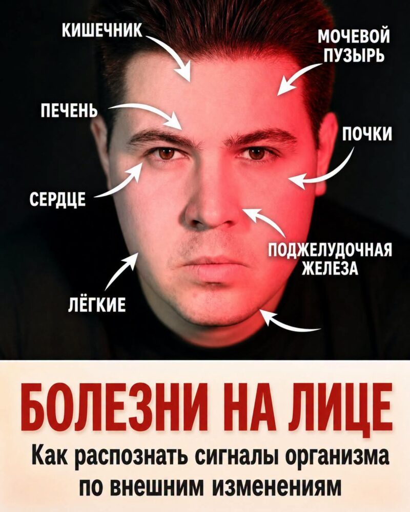Подробности ищите в первом комментарии.