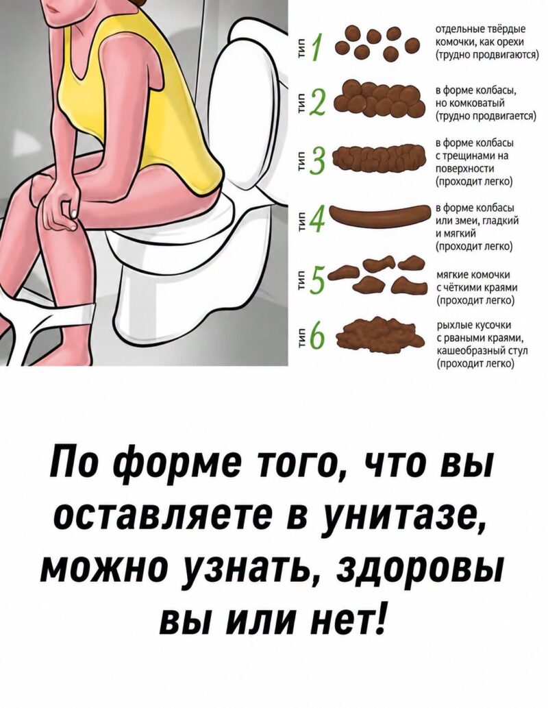 Узнайте, что форма и цвет стула могут рассказать о здоровье кишечника. Простое руководство по Бристольской шкале и советы для поддержания ЖКТ. Подробнее в первом комментарии ниже…