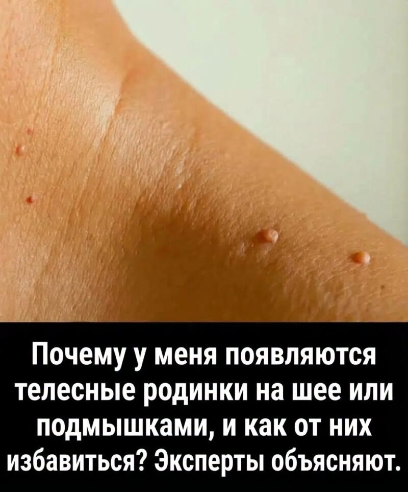 Это потому, что ты прогнил насквозь, и все это просто вырывается из тебя.