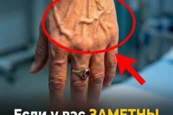 Чи видно ваші вени крізь шкіру? Можливо, ваше тіло намагається сказати вам ЦЕ…