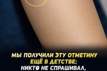Небольшой круглый шрам на руке: что он может означать (Сначала проверьте все комментарии