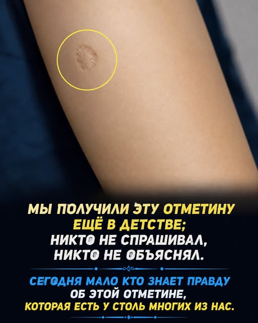 Небольшой круглый шрам на руке: что он может означать (Сначала проверьте все комментарии