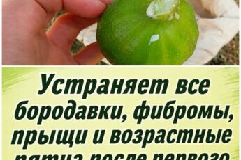 Натуральные средства для удаления бородавок, прыщей и возрастных пятен. Домашние рецепты помогут вернуть коже чистоту и здоровое сияние быстро и безопасно.