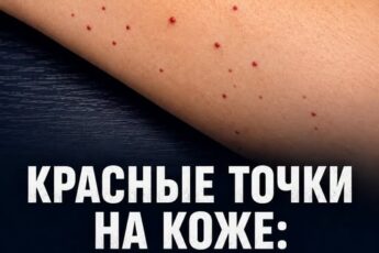 Если вы заметили на своей коже эти красные точки, вам лучше знать, что они означают