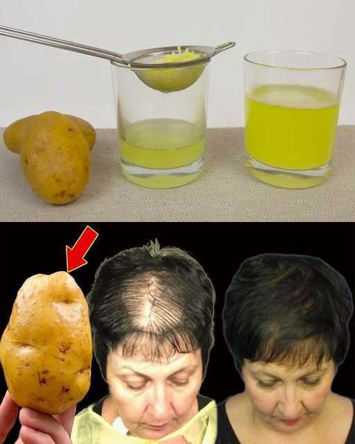 Волосы растут как сумасшедшие и не выпадают! Это самый мощный рецепт! (А вы знали это? )