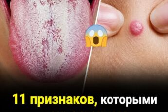 Не игнорируйте эти 11 тревожных сигналов, которые подаёт ваше тело