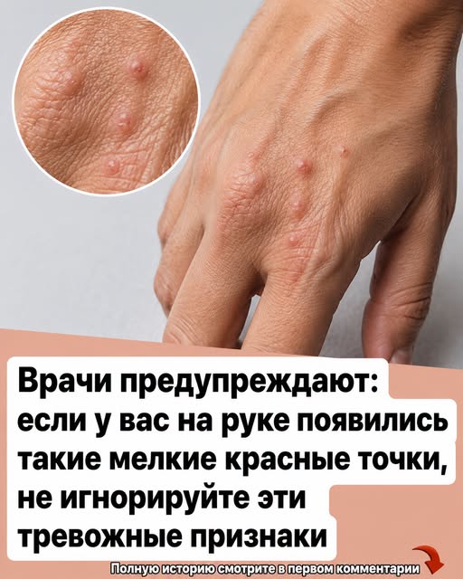Врачи предупреждают: если вы заметили на руке или кисти эти маленькие красные точки, не игнорируйте тревожные сигналы