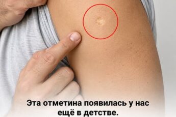 Что на самом деле скрывается за загадочным круглым шрамом на плече