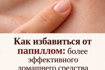 Как избавиться от папиллом: более эффективного домашнего средства просто не существует. Лучший способ! Делюсь в первом комментарии