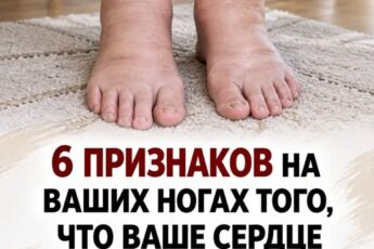 6 признаков на ваших ногах того, что ваше сердце скоро прекратит биться Делюсь в первом комментарии