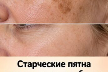 Старческие пятна ИСЧЕЗЛИ, когда я добавила в рацион эти 4 простых продукта.