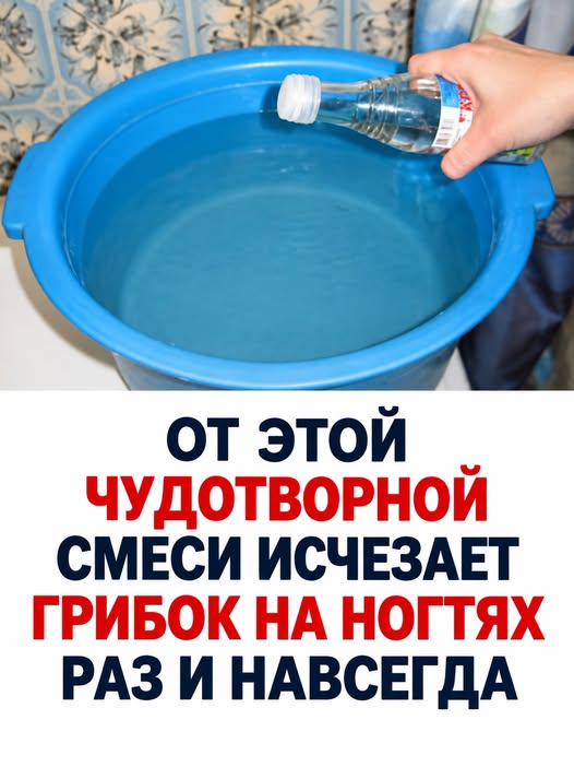 От этой чудотворной смеси исчезает грибок на ногтях раз и навсегда
Рецепт в первом комментарии